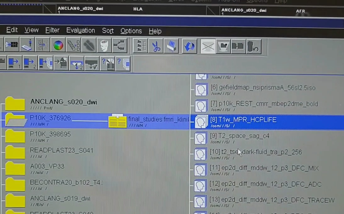 Selecting the sequence folder in the file browser